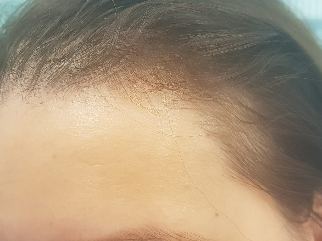 Dermatografie Haarlijn Irma Hulscher Cosmetics door Ihrye Choi Na 1ste behandeling